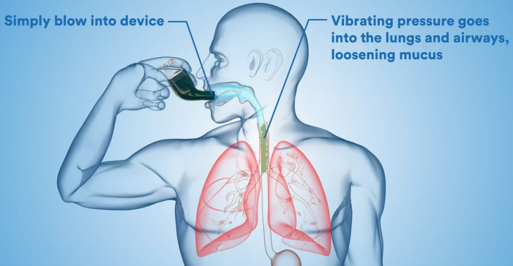 Airphysio Vs Tilcare